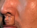 Черви лезут из лица человека Невероятное, шокирующее, страшное и интересное видео Удивительные факты